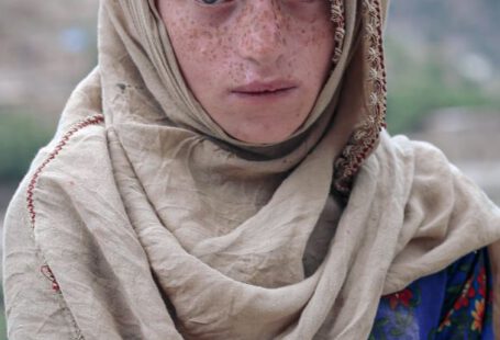 Authenticity - Portrait of a Boy with Freckles, Wearing a Headscarf