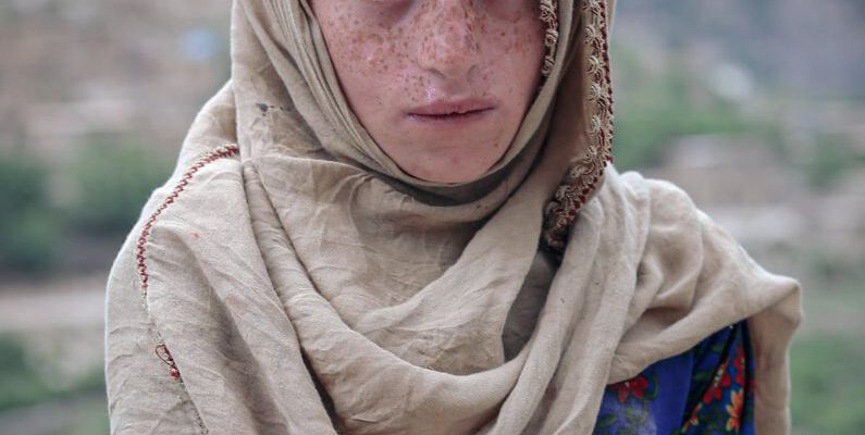 Authenticity - Portrait of a Boy with Freckles, Wearing a Headscarf